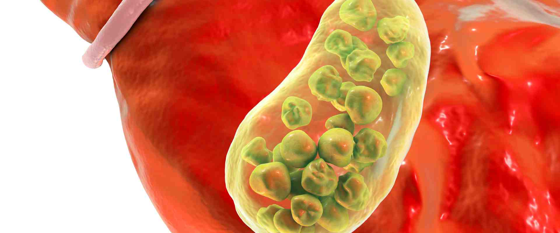 The amazing liver and gallbladder flush Colonic Training